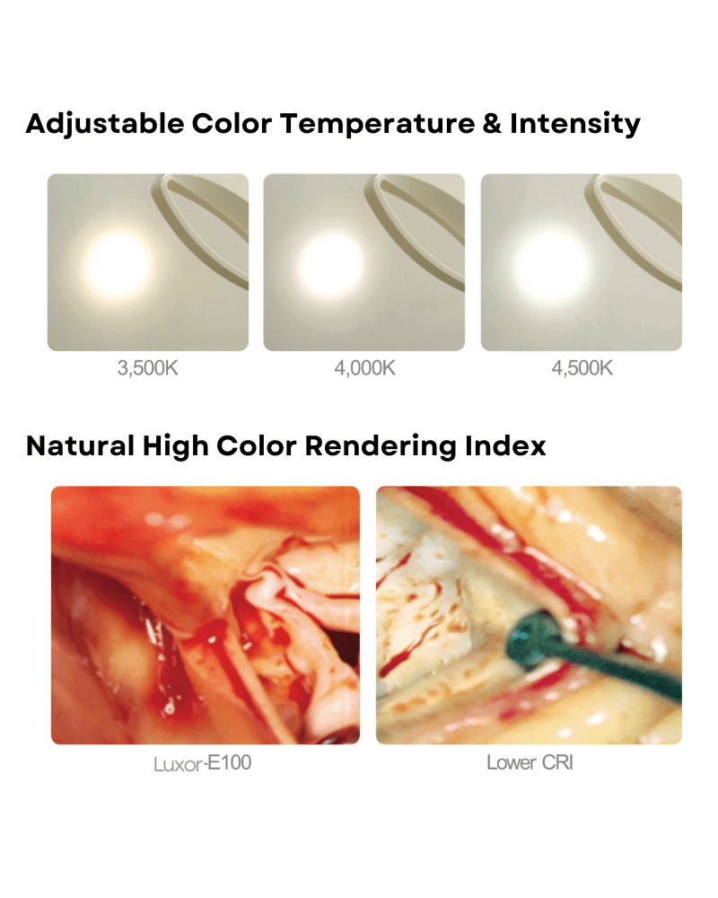Luxor 100 Series Procedure & Exam Lights