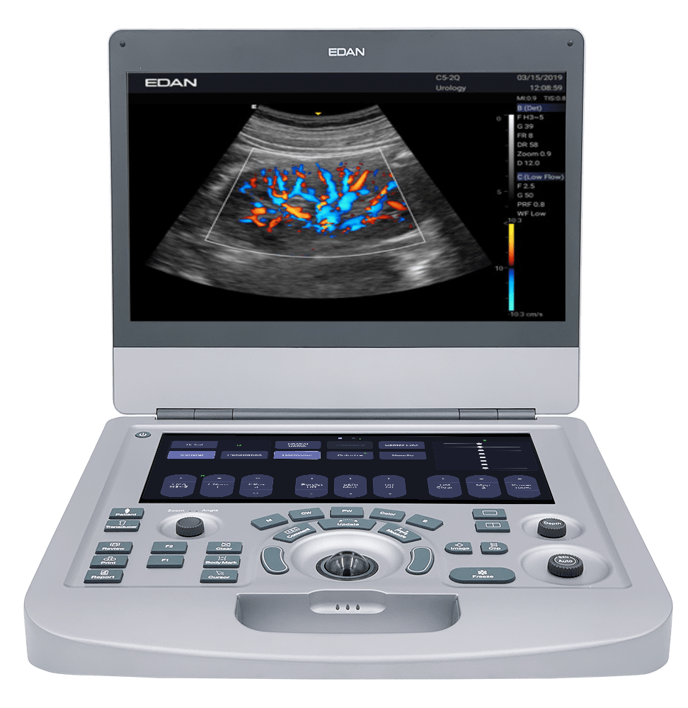 Acclarix AX Series Compact Laptop Veterinary Ultrasound System