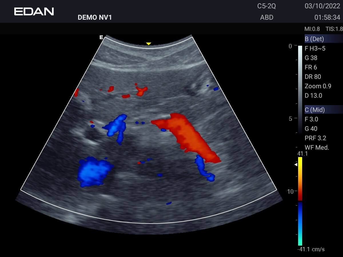 Acclarix AX Series Compact Veterinary Ultrasound System