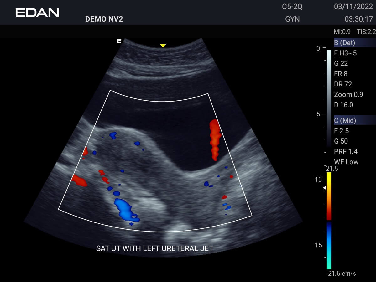 Acclarix AX Series Compact Veterinary Ultrasound System