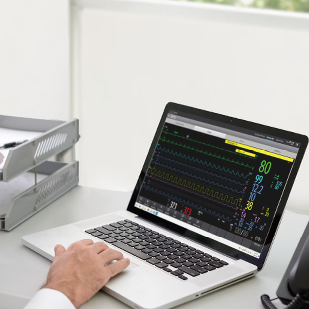 Clinician reviewing BeneVision CMS Vet waveforms on a laptop with CMS Viewer