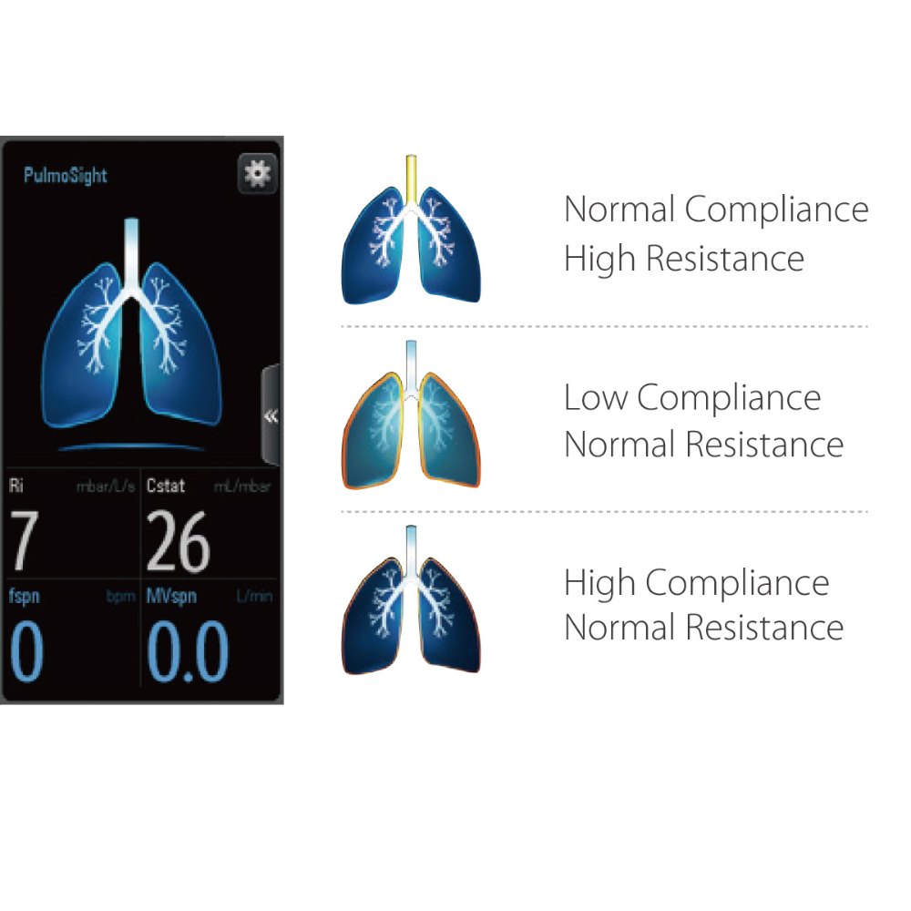Mindray SV300 Vet PulmoSight lung graphics for compliance and resistance states