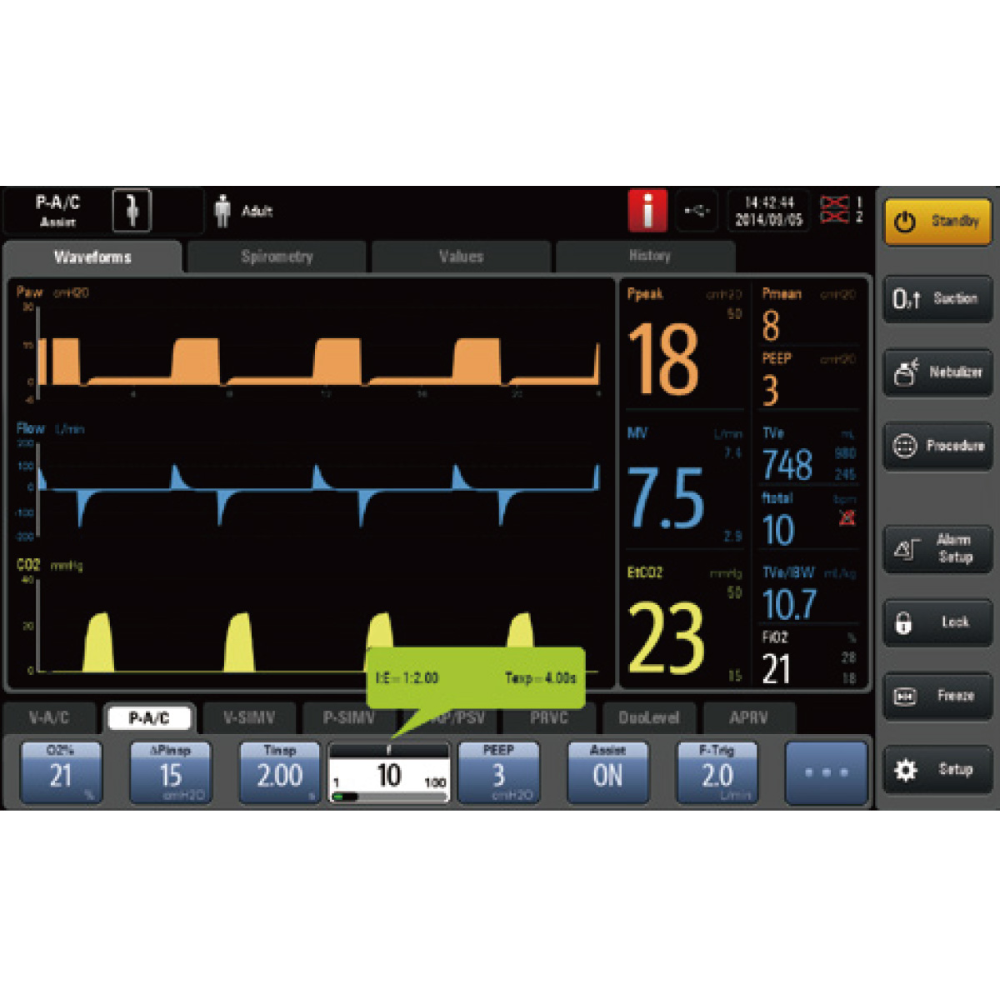 Mindray SV300 Vet touchscreen with pressure, flow, and CO2 waveforms beside measured values