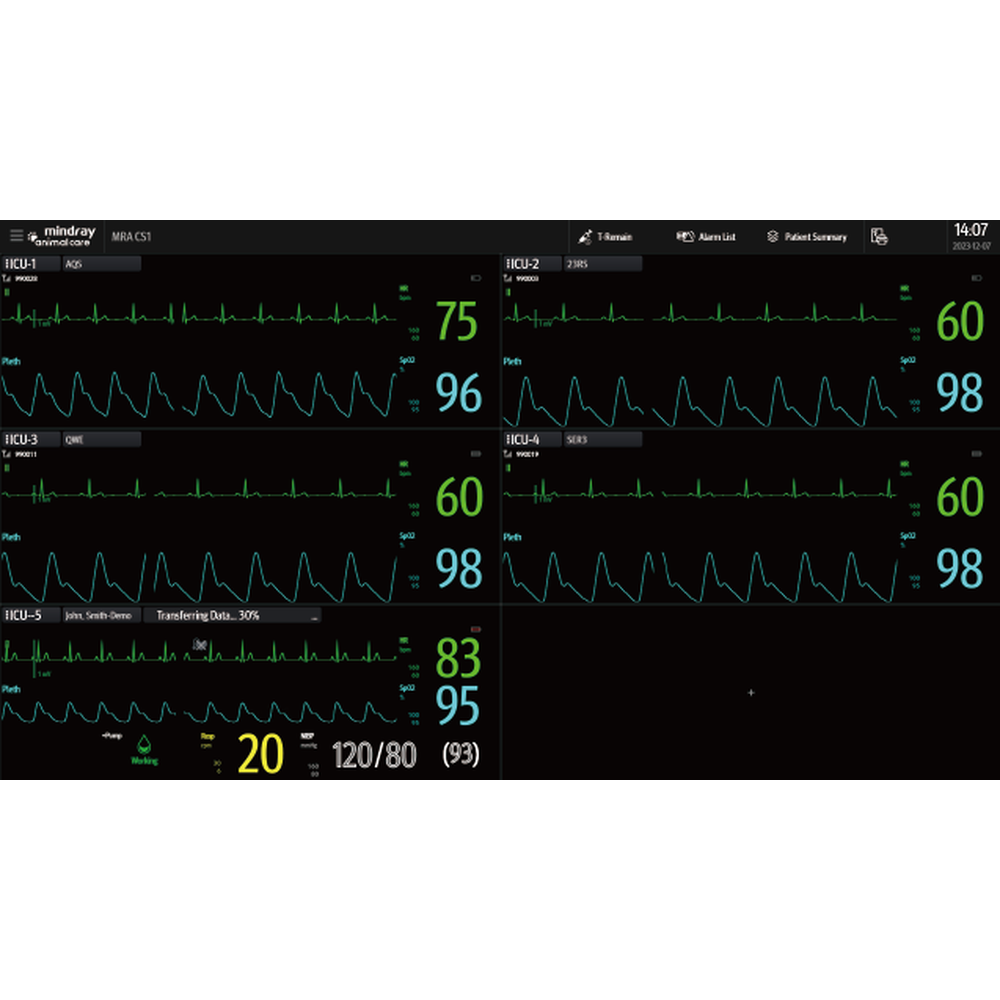 Mindray central monitoring screen with ECG waveforms and numeric values for five patients