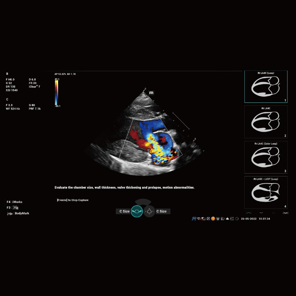 Mindray Vetus 9 iWorks cardiac protocol screen with a color Doppler heart view and a list of protocol views